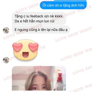 Serum trị mụn Love Skin White 25ml (Tặng 1 lọ 5ml)
