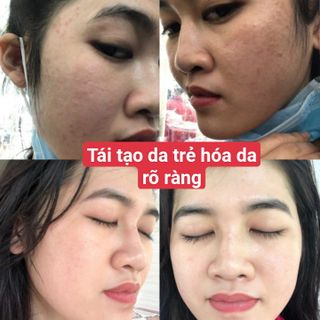 TÁi TẠO DA