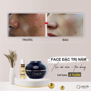 Kem đặt trị nám chính hãng queenie Skin