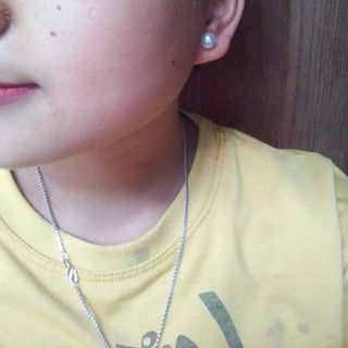 chấm tàn nhang nốt ruồi đông y gia truyền