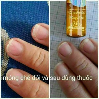 Dưỡng móng sh