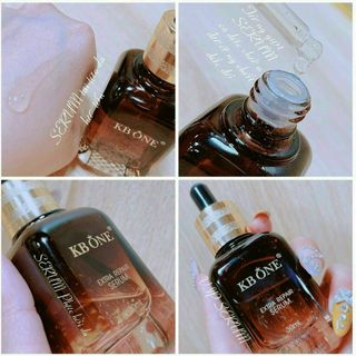 Serum collagen kbone