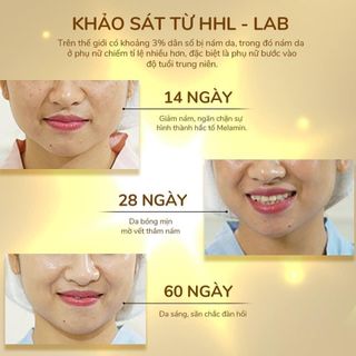 KEM HUYẾT YẾN TRỊ NÁM