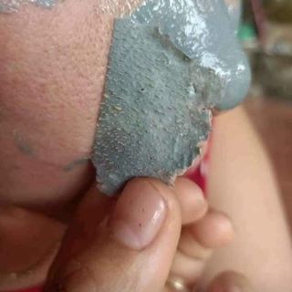 Gel hut MUN