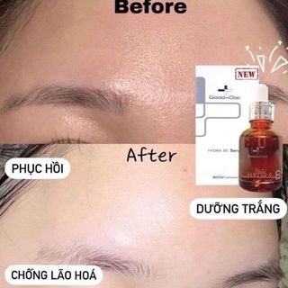 SERUM GOODNDOC HYDRA B5 HÀN QUỐC CHÍNH HÃNG 30ML