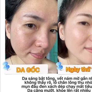 Bộ sản phẩm da liễu Tán Ngọc Nhan