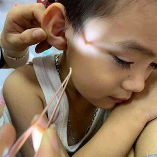 Dụng cụ lấy ráy tai có đèn giá sỉ - giá bán buôn