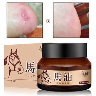 Kem dầu ngựa trị nứt gót chân