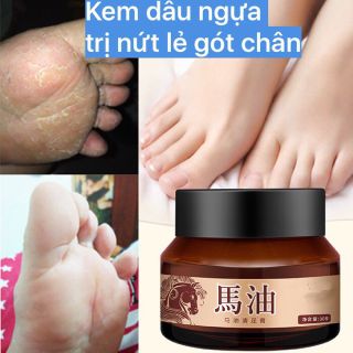 Kem dầu ngựa trị nứt gót chân