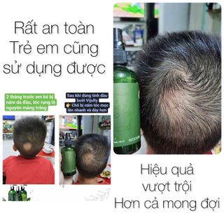 Dầu xả dừa hoa cúc Vijully phục hồi tóc hư tổn, giảm xơ rối chẻ ngọn 280ml
