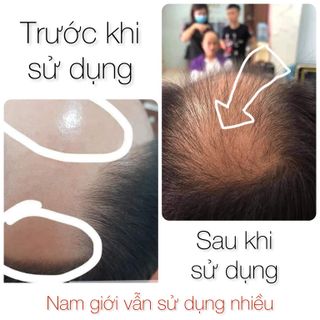 Dầu gội bưởi Vijully ngăn rụng tóc hiệu quả sau 2-3 tuần sử dụng
