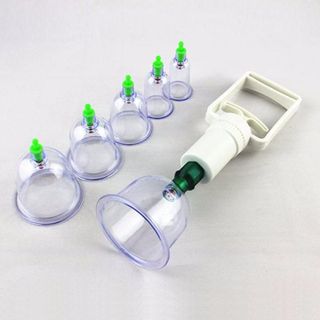 Bộ giác hơi 12 món không dùng lửa
