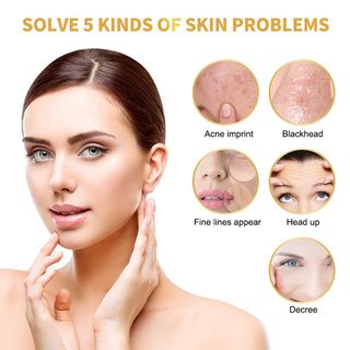 Mặt Nạ Lột mụn 24K Aichun giúp làm sạch mụn mụn đầu đen , mụn cám
