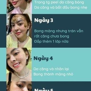 TINH CHẤT TÁI TẠO DA SKIN PEELING RETINONL VI TẢO tTRANG NEMO