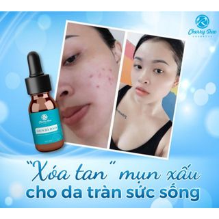 kem giảm mụn mờ thâm