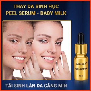 [Hot] Thay Da Sinh Học Peel Serum Baby Milk 10ml - Hàng Hiệu Vũ Phạm giá sỉ