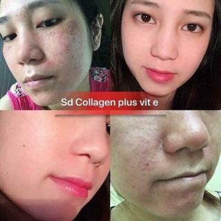Kem collagen plus vit e