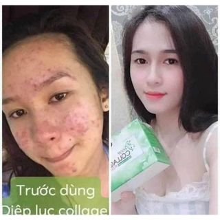 Diệp Lục Collagen (bổ sung nội tiết tố)