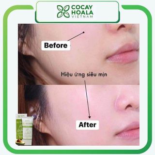 KEM TRẮNG DA CHỐNG NẮNG BƠ NGHỆ