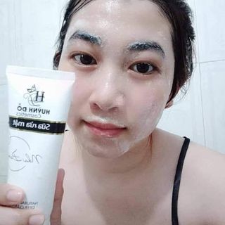 SỮA RỬA MẶT NHA ĐAM NGĂN NGỪA MỤN