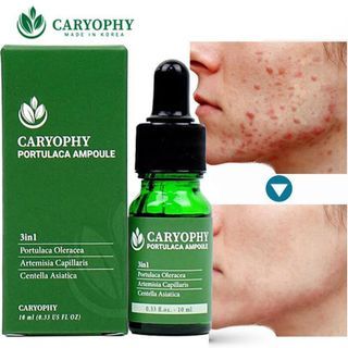 Serum mụn, thâm Caryophy Portulaca 10ml chính hãng Hàn Quốc