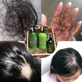 Tinh dầu bưởi dưỡng tóc Vijully kích mọc tóc, giảm gãy rụng, làm mềm tóc 100ml