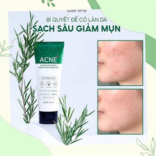 SỮA RỬA MẶT TRỊ MỤN AHA-BHA-PHA 100ML - SOME BY MI