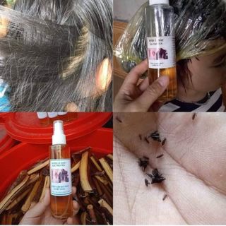 Ủ Chấy (chí) Gia Truyền