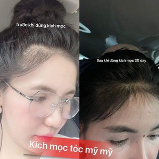 KÍCH MỌC TÓC THẢO DƯỢC - MỸ MỸ