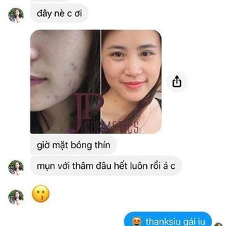 JP comartic chuyên trị nám tàn nhan