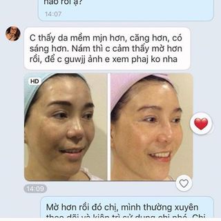 JP comartic chuyên trị nám tàn nhan
