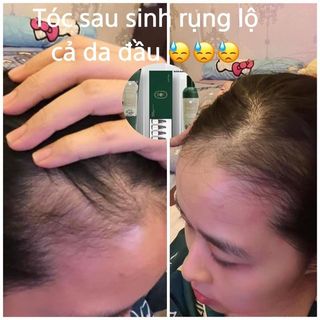 DẦU GỘI GỪNG HÀ THỦ Ô DÀNH CHO TÓC KHÔ,HƯ TỔN ( GỘI,XẢ) giá sỉ - giá bán buôn