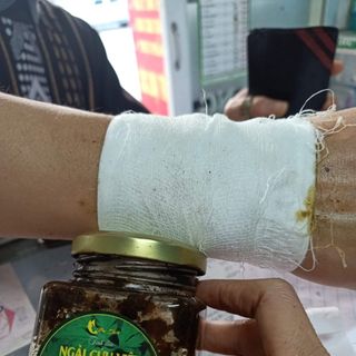 Tinh dầu ngải cứu Việt 200ml - Xoa bóp đặc trị cho người đau cơ xương khớp