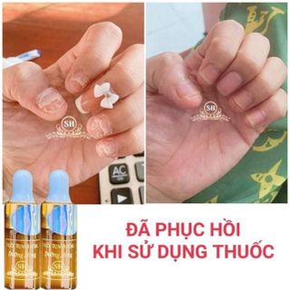 Serum nấm móng tay sh