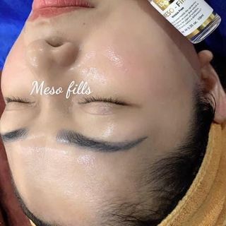 Tinh chất colagen Meso filler isov Korea