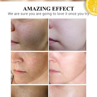 Kem dưỡng ẩm Vitamin C Disaar tăng cường dưỡng ẩm da , chống lão hoá và căng bóng da 50ml