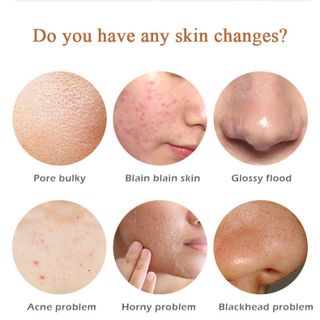 Serum Glow Tonic nha đam chuyên trị và ngừa các loại 30ml mụn