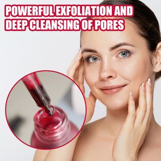 Serum đỏ AHA30% + BHA 2% EELHOE phối hợp cùng tinh chất rau củ giúp da chắc khoẻ, se khít lỗ chân lông, trị mụn