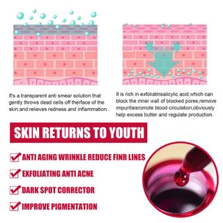 Serum đỏ AHA30% + BHA 2% EELHOE phối hợp cùng tinh chất rau củ giúp da chắc khoẻ, se khít lỗ chân lông, trị mụn
