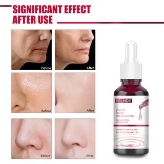 Serum đỏ AHA30% + BHA 2% EELHOE phối hợp cùng tinh chất rau củ giúp da chắc khoẻ, se khít lỗ chân lông, trị mụn