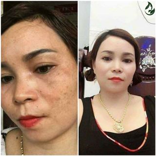 Kem Ngăn Ngừa Nám Tàn Nhang Mộc Thiên Hương