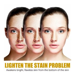 Serum chuyên trị nám JaySuing ,cải thiện sắc tố da , dưỡng da