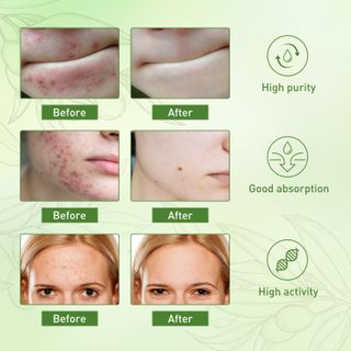 Serum Oilves JaySuing điều trị mụn , giúp da đều màu , chống lão hoá 30ml