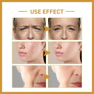 Serum Gạo Rice Raw Lulp trị mụn , chống lão hoá , trị nám 20ml