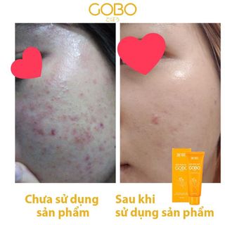 [TẶNG MIẾNG MÚT RỬA MẶT] Sữa rửa mặt làm sạch sâu Cocayhoala 100g