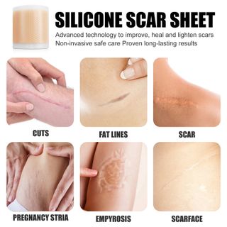 Miếng dán trị sẹo Silicon tự dính thần thánh cho mọi người
