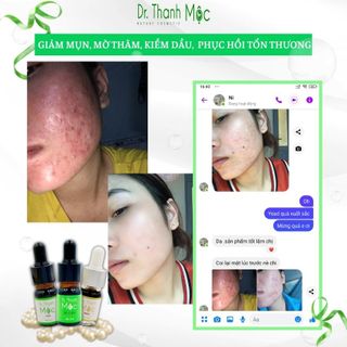 serum DR THANH MỘC NANO trị mụn, dưỡng da, mờ thâm, phục hồi da mỏng yếu GIÁ SỈ - giá bán buôn