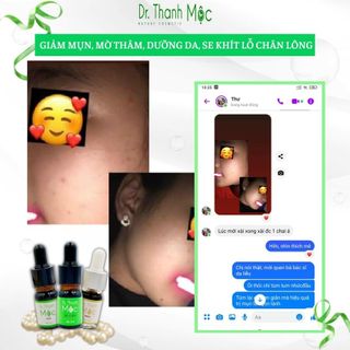 DR THANH MỘC skincare trị mụn thảo dược 5ml