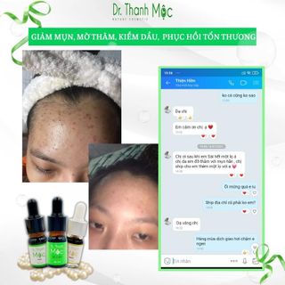 DR THANH MỘC skincare trị mụn thảo dược 5ml