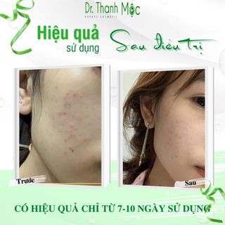 DR THANH MỘC PURE giảm mụn, mờ thâm, cấp ẩm GIÁ SỈ- giá buôn